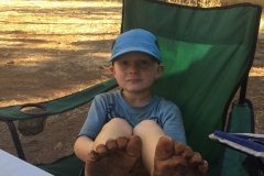 Die Füsse sind auch betroffen